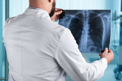 lung health xray bronchiectasis