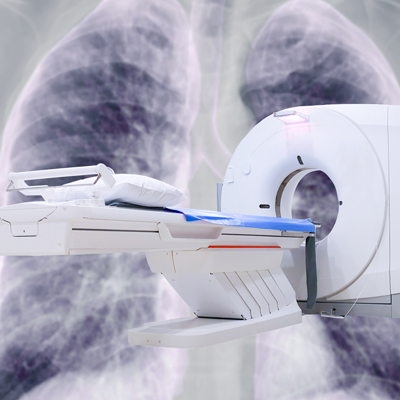 ct scan for lung disease